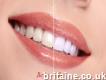 La Teeth Whitening - Marlow