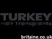Turkey Hair Transplants